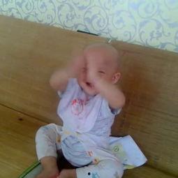 小孩吃瓜吃进鼻子,儿童意外事件引关注