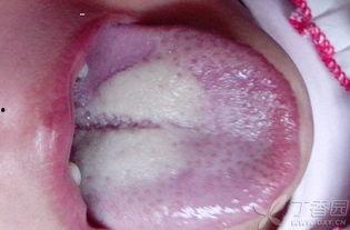 吃瓜舌苔白厚,揭秘吃瓜背后的健康密码